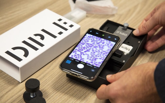 DIPLE Smartphone microscope